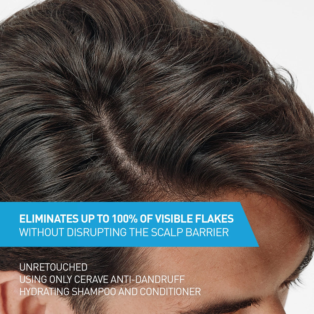 Hydrating anti Dandruff Shampoo Sulfate Free & Color Safe Itchy Scalp Treatment