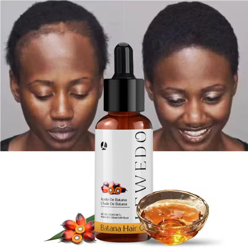 Natural Batana Oil Serum for Hair Growth Healthier Thicker Fuller anti Hair Loss