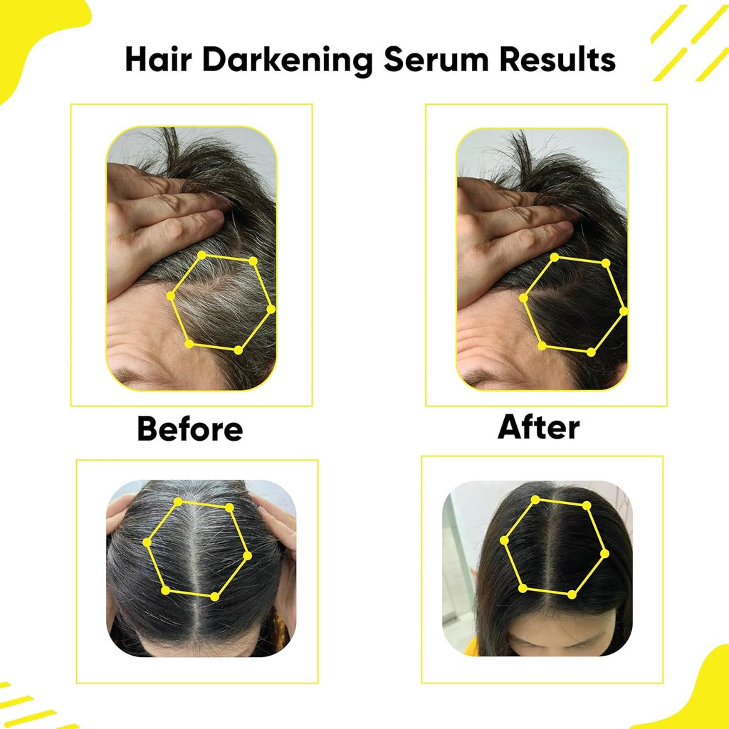 Anti Gray Hair Darkening Serum | Reverses & Limits Hair & Beard Graying with Arc