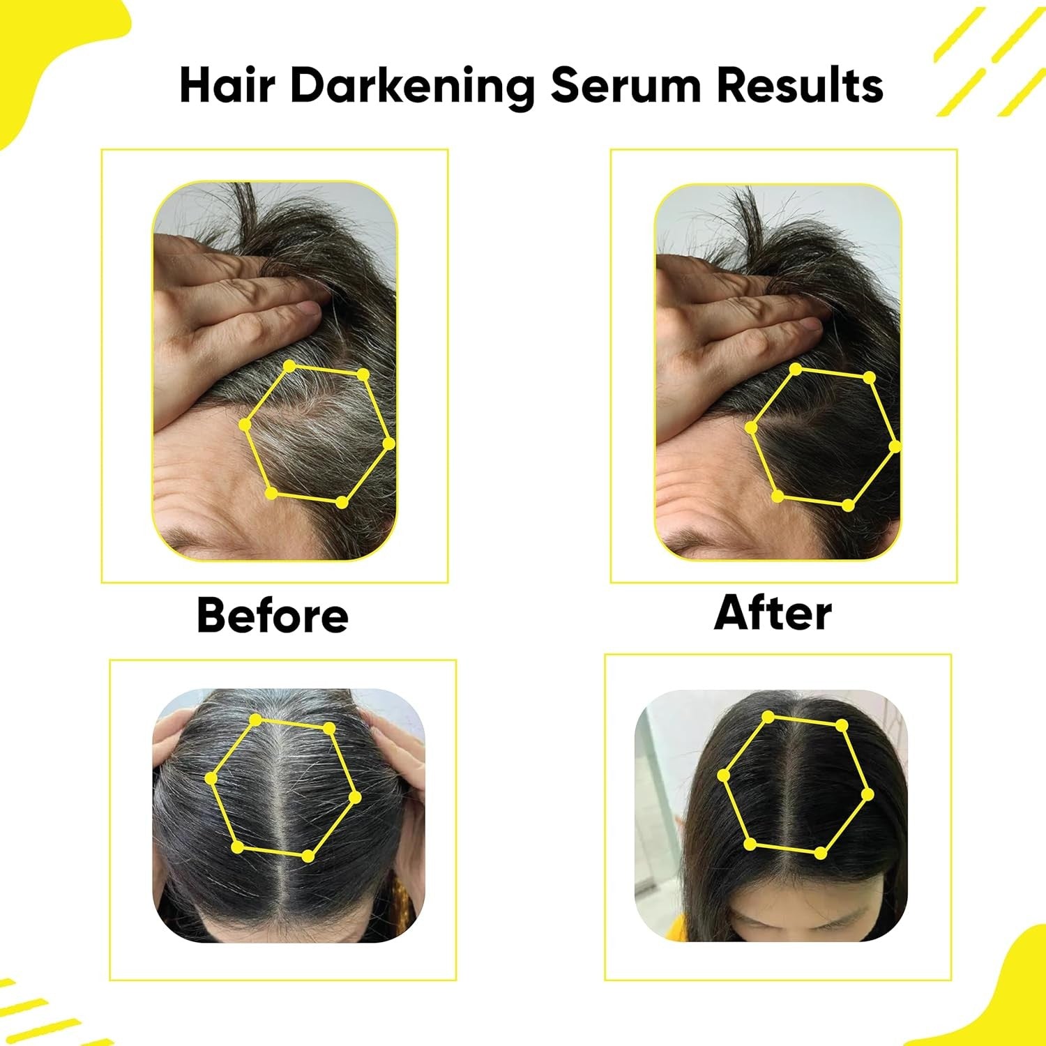 Anti Gray Hair Darkening Serum | Reverses & Limits Hair & Beard Graying with Arc