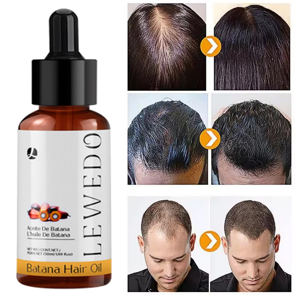 Natural Batana Oil Serum for Hair Growth Healthier Thicker Fuller anti Hair Loss