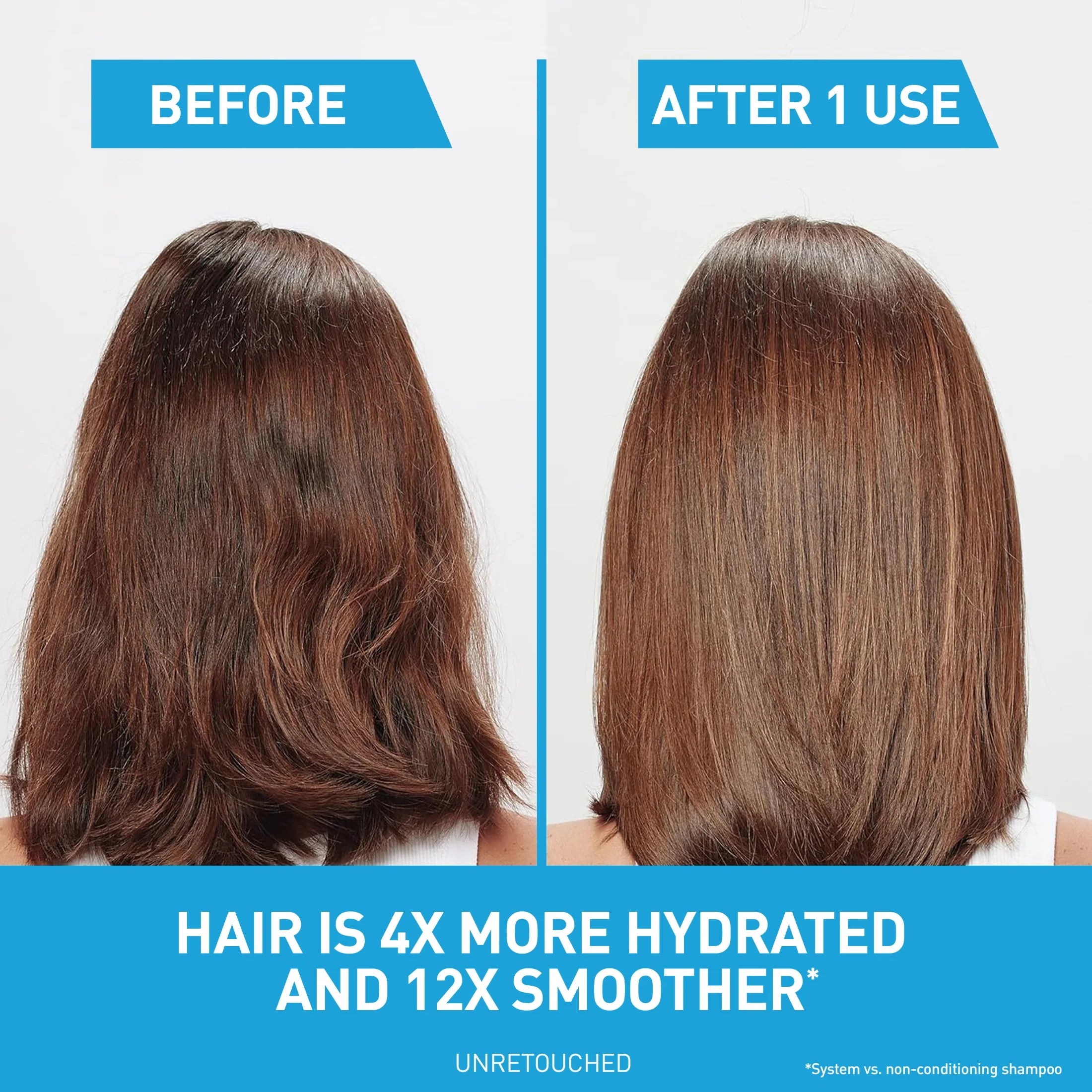 Hydrating anti Dandruff Shampoo Sulfate Free & Color Safe Itchy Scalp Treatment