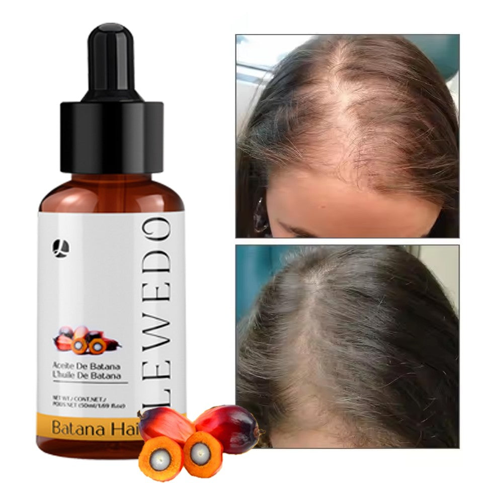 Natural Batana Oil Serum for Hair Growth Healthier Thicker Fuller anti Hair Loss