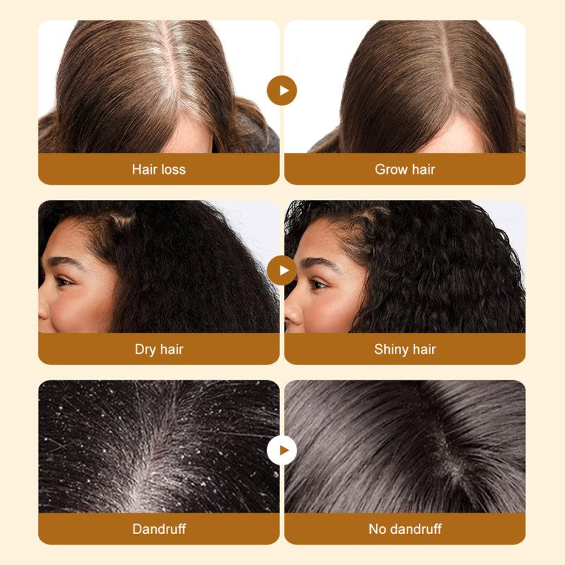 Natural Batana Oil Serum for Hair Growth Healthier Thicker Fuller anti Hair Loss